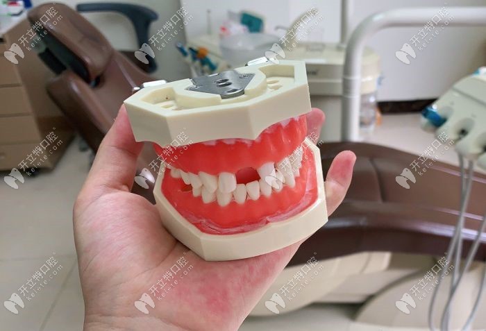 粤北口腔的牙齿模型