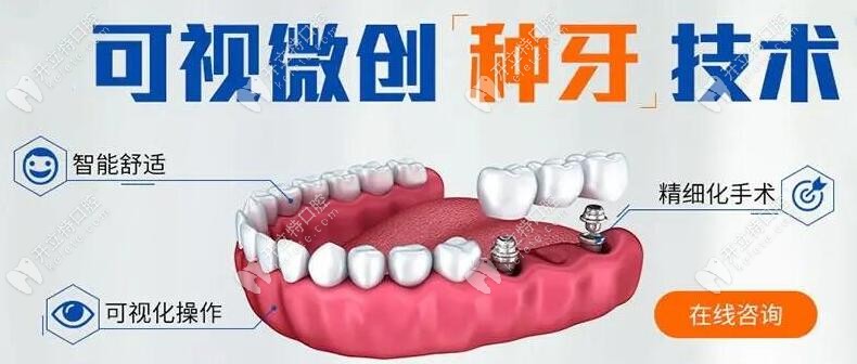微创种植牙技术优势