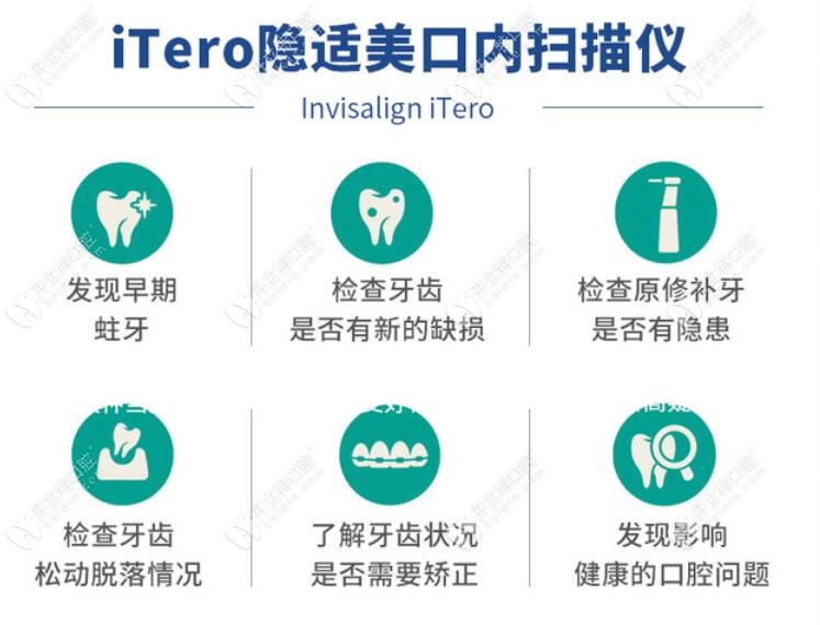 ITERO口腔扫描仪