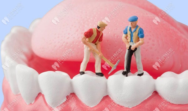 牙周条件太差可以种植牙吗？如果可以该选哪种植呢