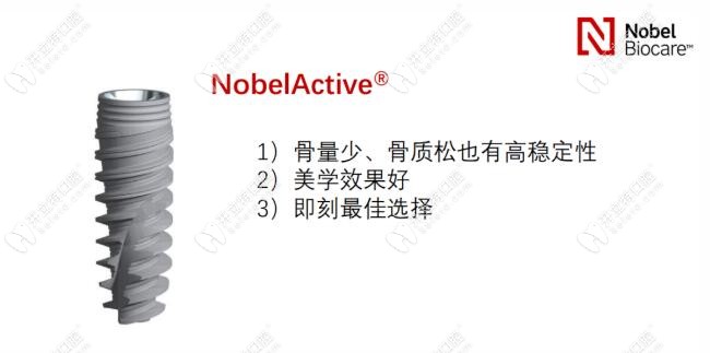 诺贝尔active植体优势