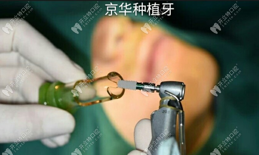 贵阳京华口腔种植牙手术中