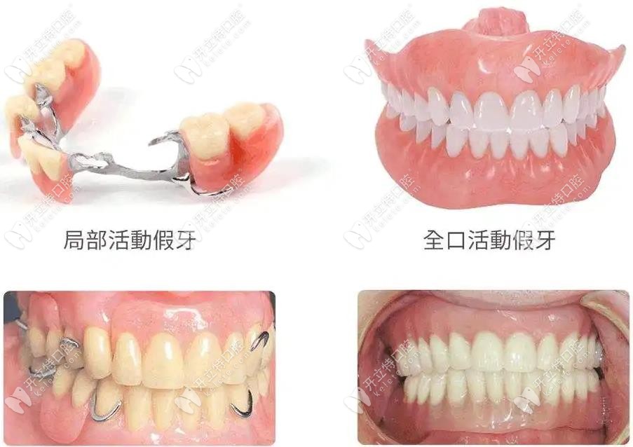 绵阳馨康口腔的牙齿美容修复技术