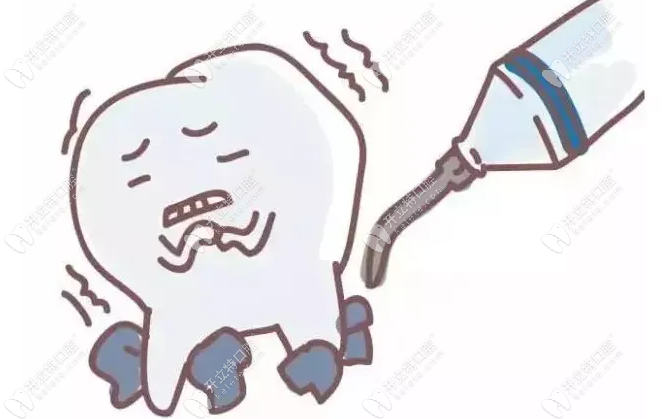 牙科医生从来不洗牙也是不可能的