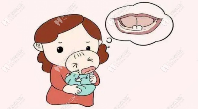 宝宝出生就有的牙齿叫诞生齿
