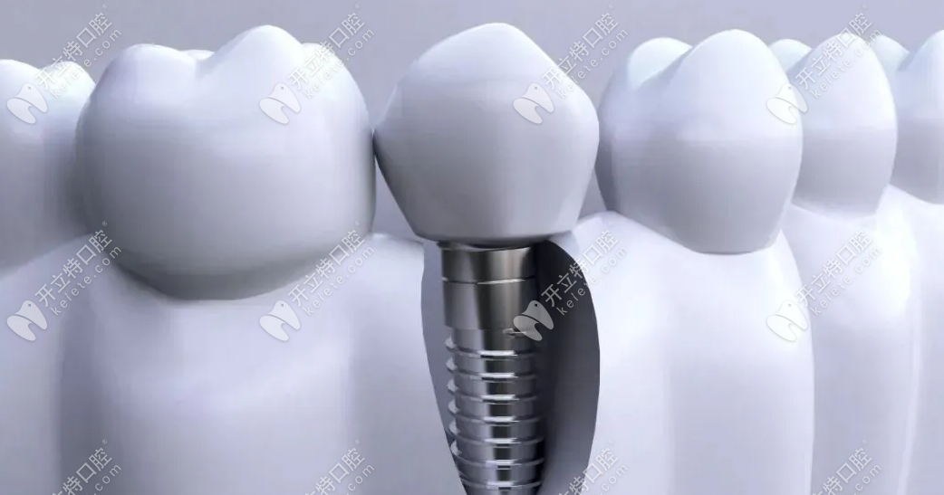 宜昌哪家医院种植牙技术比较好?半全口种植建议去这两家