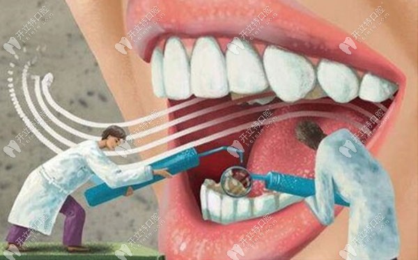 牙博士口腔医院洗牙