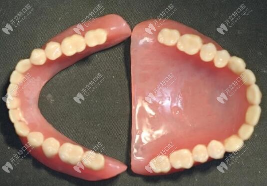 全口假牙坏了怎么办?修复满口活动义齿的方法分享给你
