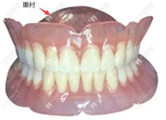 全口活动义齿的修理方法