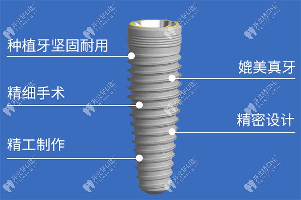 瑞典诺贝尔种植体收费