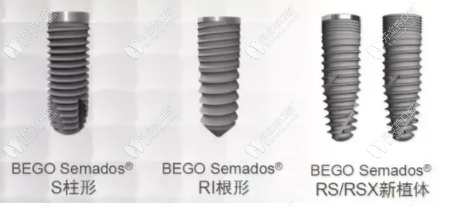德国贝格bego种植体型号中的RSX与SCX的区别介绍请查收