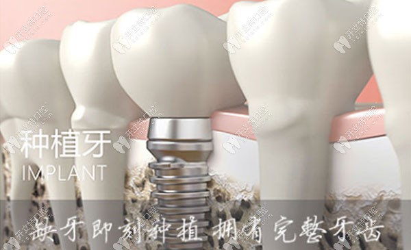 拔牙臉?biāo)俜N回去有用