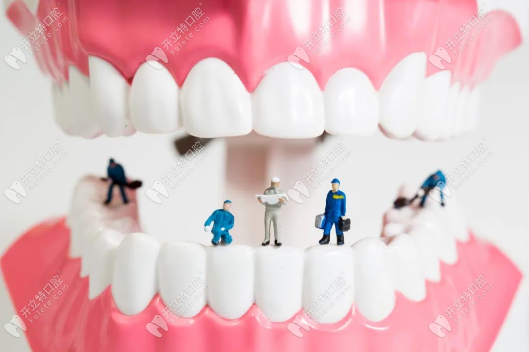 缺牙的不同修复方式