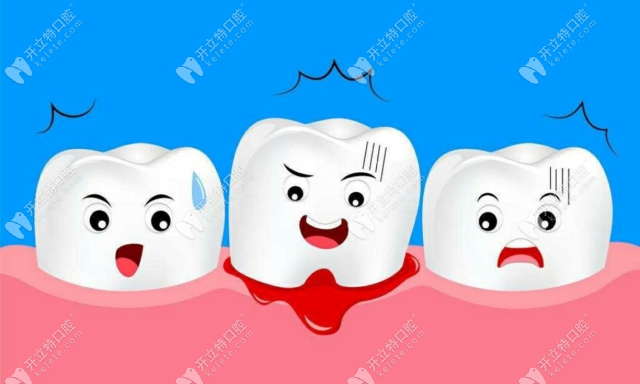 牙龈出血症状