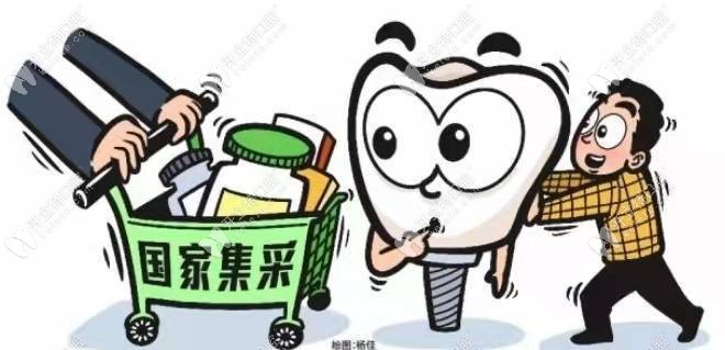 广州种植牙集采什么时候开始