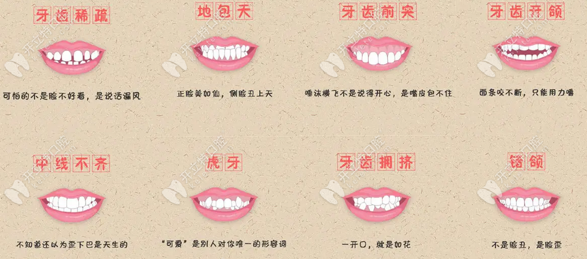 瓜沥口腔正畸科可治疗的牙齿情况