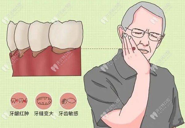牙龈萎缩还分生理性萎缩和病理性萎缩