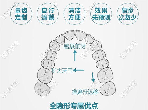 深圳益美口腔隐形矫正