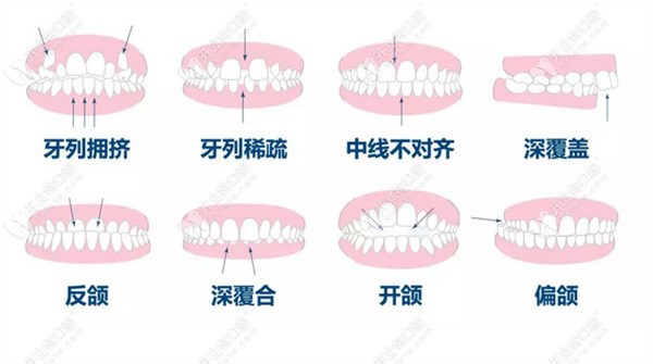 深圳益美口腔牙齿矫正