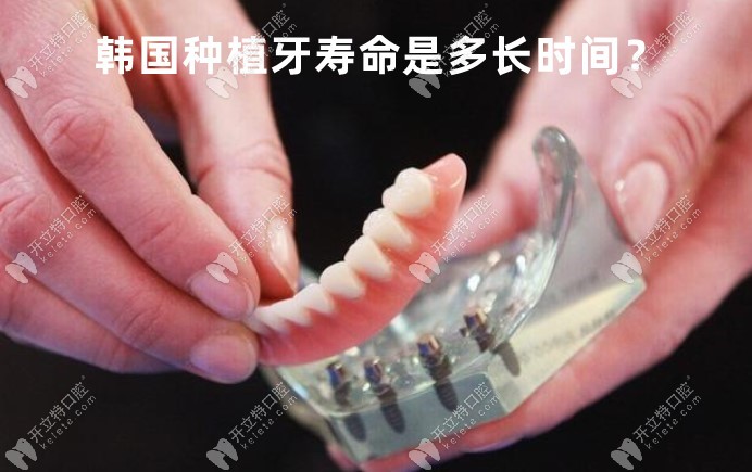 韩国种植牙使用使命是多少年kelete.com