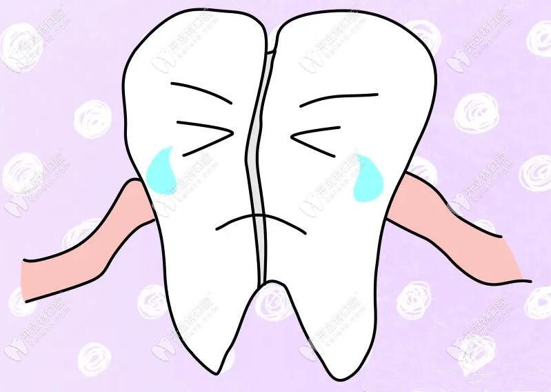 牙隐裂是什么原因引起的