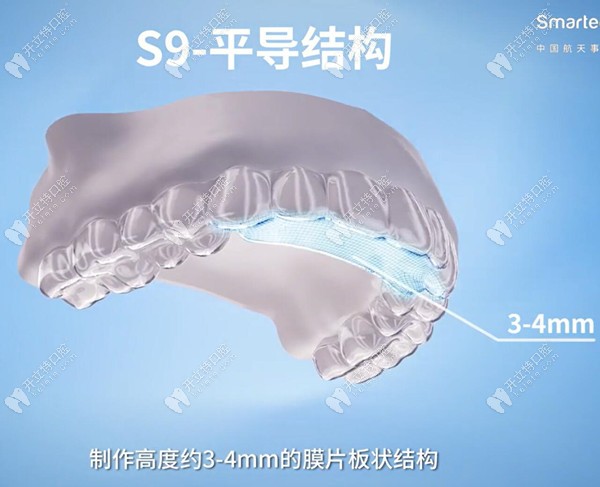 正雅s9隐形矫正器的适应症是颌位重建