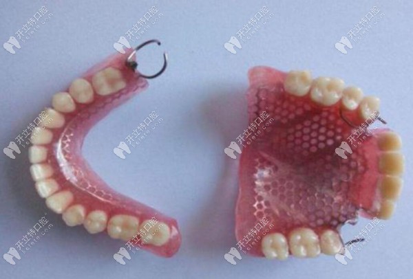 纯钛活动假牙有没有副作用