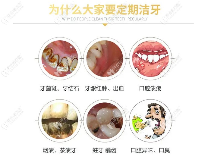 榆林雅美口腔潔牙的好處