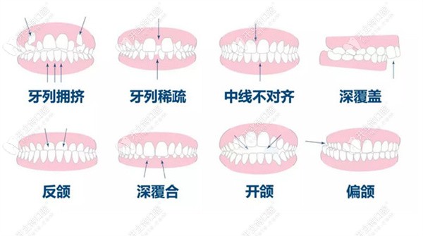 杭州上城胡佳口腔诊所牙齿矫正