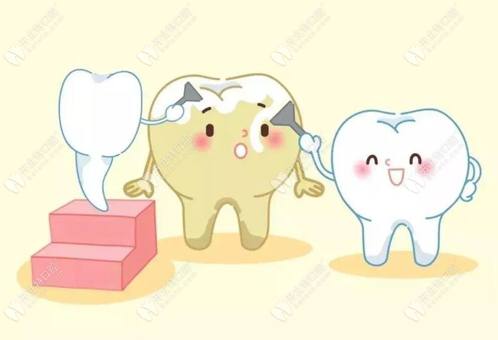 长治洗牙收费价目表:含超声波龈上洁治+牙周龈下刮治的费用