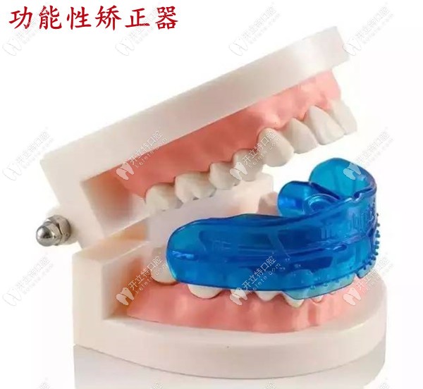 兒童功能性矯正器