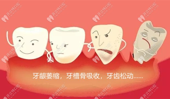 为什么会过早发生牙龈萎缩