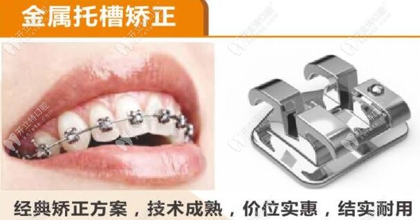 深圳正夫口腔金属托槽牙齿矫正器