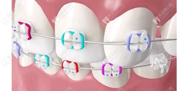 重庆牙博士口腔医院牙齿矫正