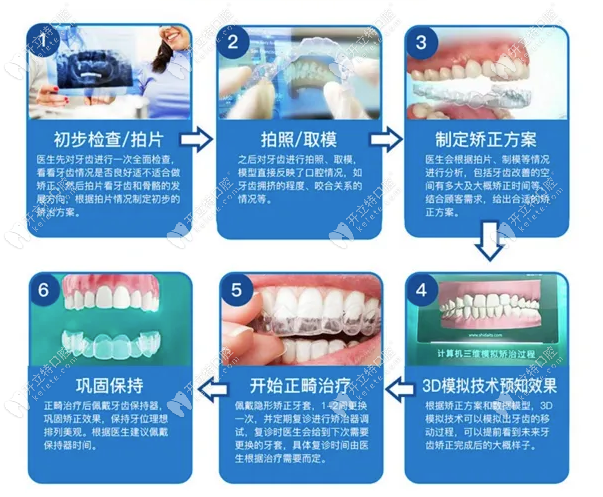 牙齿矫正的过程