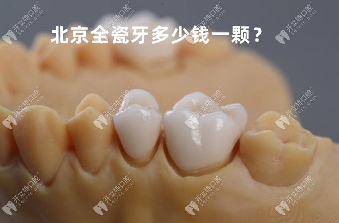 北京全瓷牙冠价格表2022，含国产和进口氧化锆牙套价格