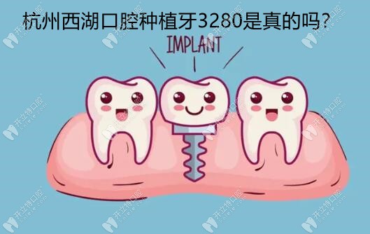 杭州西湖口腔医院种植牙3280元是真的,还是叶宝定医生亲诊