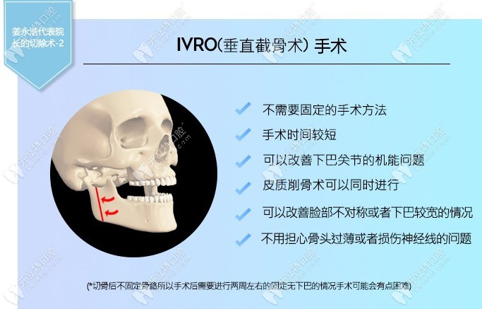 IVRO（垂直截骨术）手术优缺点