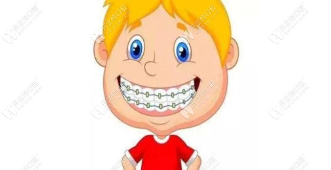 儿童牙齿矫正图片