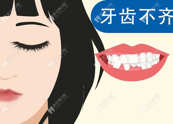 30岁的我在南京佑德口腔佩戴隐形牙套成功矫正了牙齿拥挤