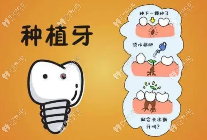 这就是种植牙卡通图