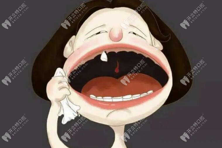如果全口缺失牙齿怎么办