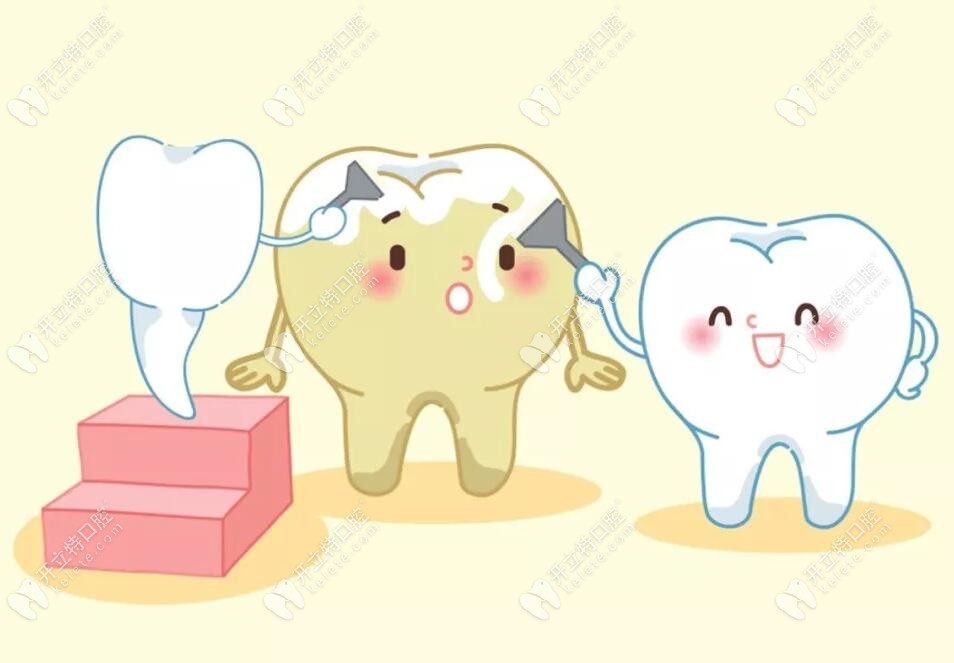 洗牙真的会导致牙缝变大吗