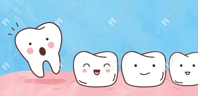 牙齿缺失问题要引起重视