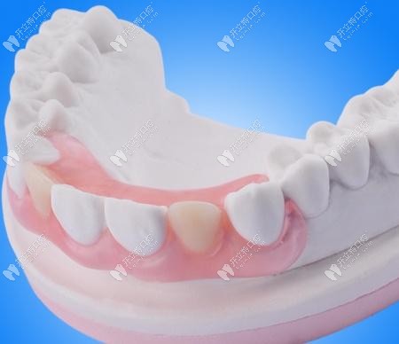 伤害较小的活动假牙是什么