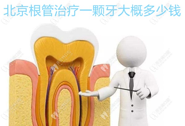北京根管治疗一颗牙大概多少钱,听说做完都得8000-1万元是吗
