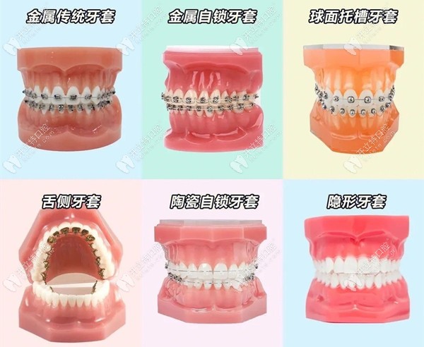 龙岩龙冠牙科牙齿矫正器品牌
