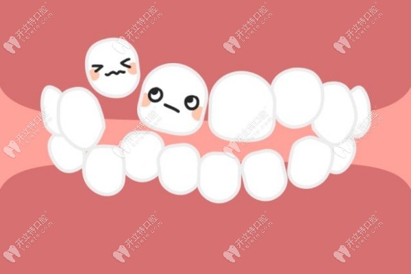 牙性反颌加牙体缺损