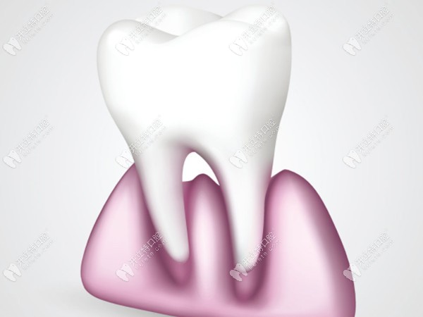三种牙冠修复方式对比