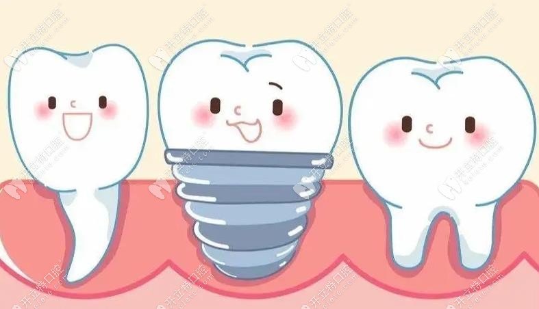 种植牙是一项个性化缺牙修复手术